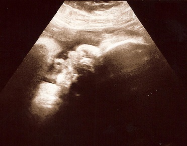 Our Little boy @ 38weeks