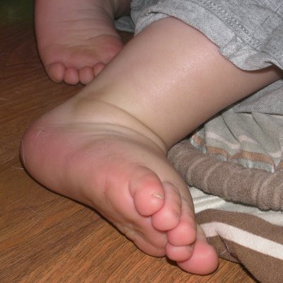 Miles' feet